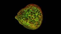 A high resolution image of a cancer cell.