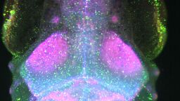 Scientific image showing Dorsal view of a 9-day old zebrafish brain