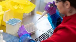 Person using a pipette on test samples