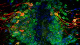 Old and newly made dopamine-producing nerve cells in the zebrafish brain