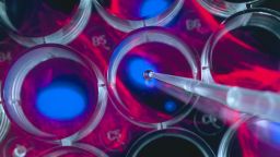 Scientist pipetting cells into a multi well plate