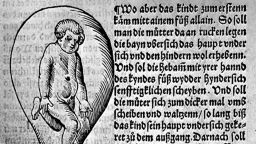 An old script with a drawing of a baby in a human organ