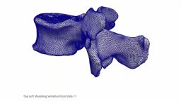 Figure: Top Left Morphing Vertebrae