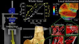 Graphical abstract - Damage tolerance and toughness of elderly human femora