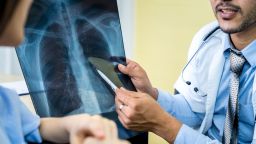 Lung X-ray