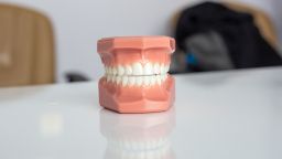 Dentist plastic model of teeth
