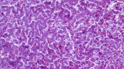 Liver tissue under a microscope