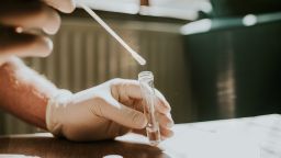 Saliva test