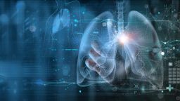 A graphic image representing the heart and lungs on a background with diagrams of the human body and statistical data represented.