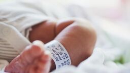 A newborn baby's leg and foot, with a hospital tag around its ankle.
