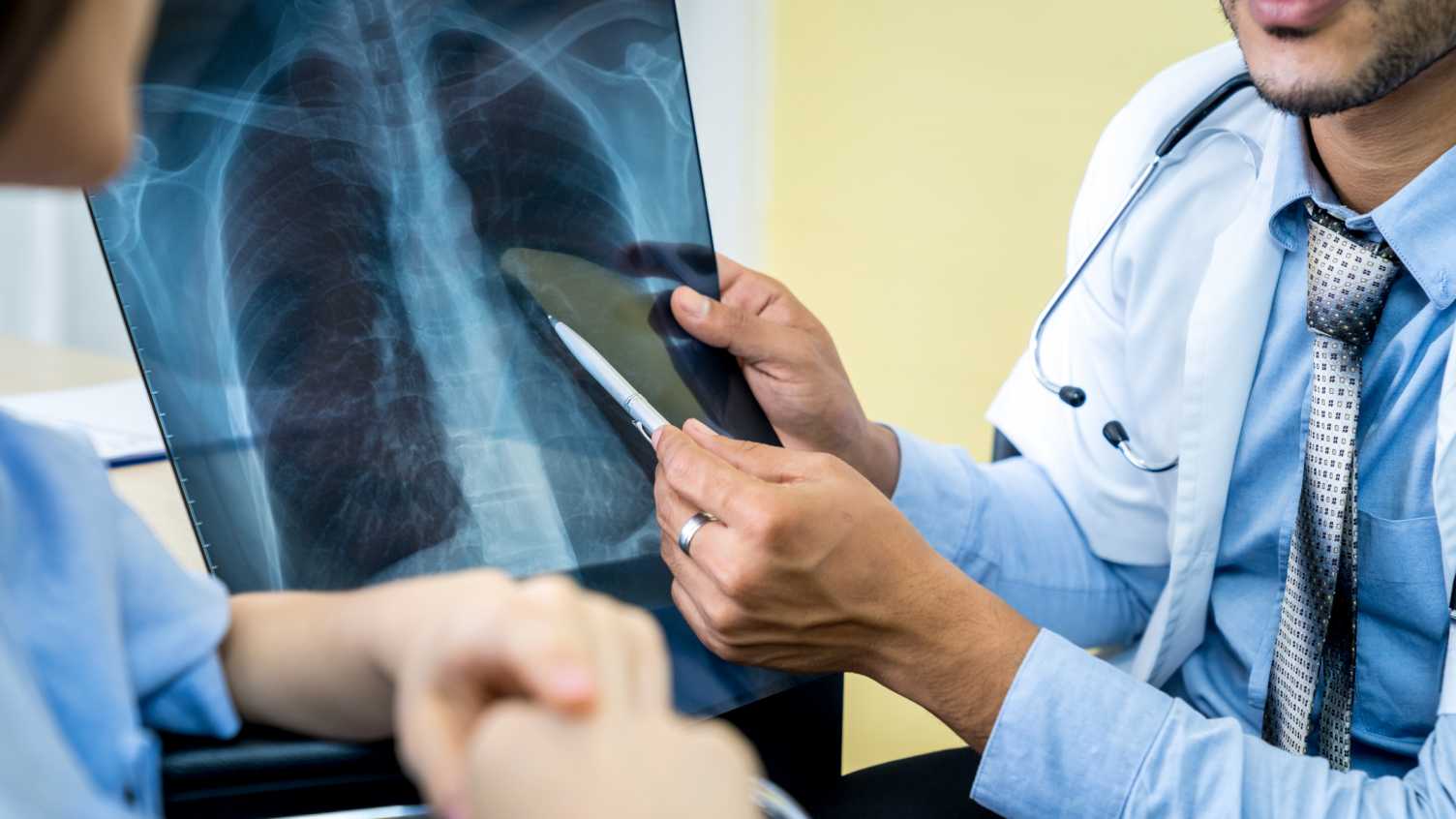 Hidden Damage To Lungs From Covid 19 Revealed In New Study From University Of Sheffield News The University Of Sheffield