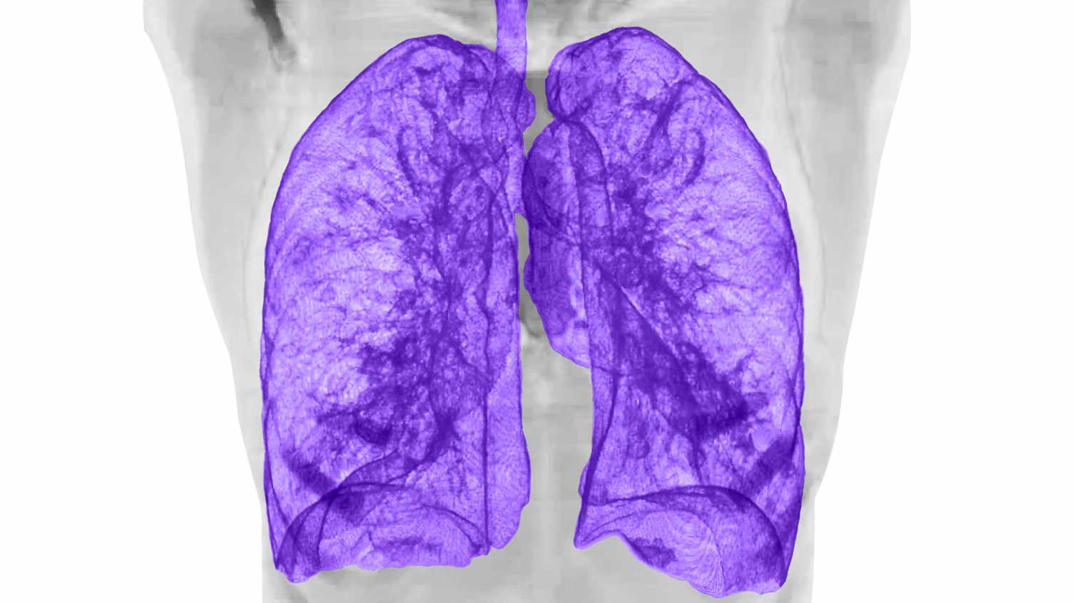 New MRI scanning technology to improve clinical accessibility and advance lung disease diagnosis | News